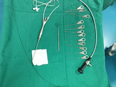 Removed stones ( parotid)
