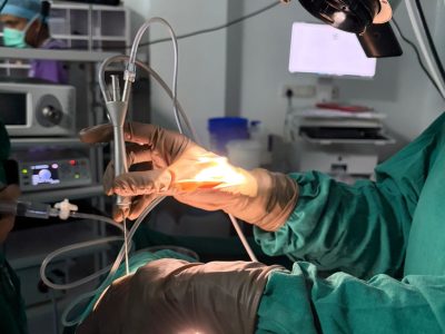 Sialendoscopy